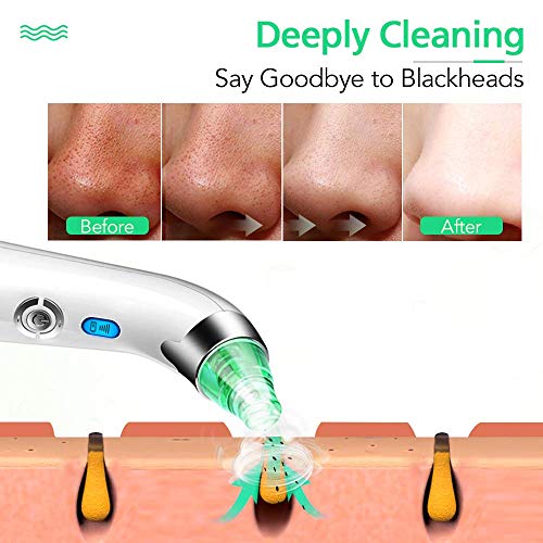 Blackhead Remover Pore Vacuum Cleaner LONOVE Upgraded Blackhead