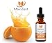 Vitamin C Serum For Face and Skin with 20% Vitamin C + E + Hyaluronic Acid – Our #1 BEST Serum to Fade Sun Spots & Discoloration – Rejuvenates & Brightens Skin – Guaranteed Glow! – 1oz (30ml)