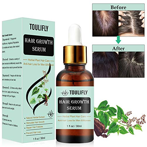 TOULIFLY Hair Growth Serum Hair Growth Treatment Oil Hair Regrowth Serum Anti-hair Loss Hair Treatment for Thinning Balding Hair Promotes Hair Growth for Men Women