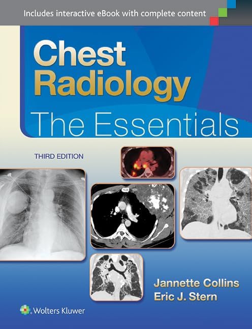 Textbook of Gastrointestinal Radiology (Volume 2): Gore, Levine