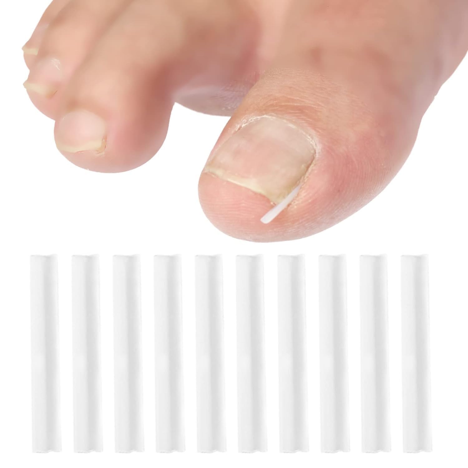 Photo 1 of 10 Pcs Ingrown Toenail Correction Strips Brace Kit, Ingrown Toenail Corrector Straightener Strips Recover Clips Toenails Thick Pedicure Tool for Men Women Foot Care Tool, Ingrown Toenail Tools