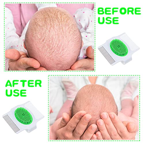 DOERDO 2 Pieces Cradle Cap Brush and Comb 3 in 1 Design Baby Comb for