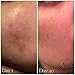 Faith & Grace Aesthetics Anti-Aging Retinol Night Cream With Amazing Anti Wrinkle & Moisturizing Properties - Advanced Formula With Encapsulated Retinol Serum For Uneven Skin Tone And Acne Scars