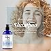 Pure Biology Hair Growth Stimulating Shampoo with Biotin, Keratin, Natural DHT Blockers, Vitamins B + E & Breakthrough Anti Hair Loss Complex for Thinning, Damaged Hair for Men & Womenthumb 4