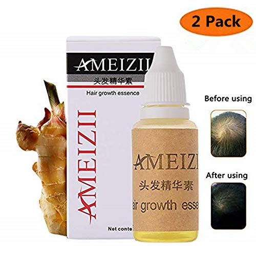 Hair Growth Serum,2019 Hair Regrowth Treatment, Hair Serum,Hair Growth Oil, Hair Growth Essence, Hair Loss Treatments, Prevent Hair Loss, Thinning Hair for Women Men (Pack of 2)