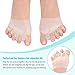 DOACT Gel Toe Separators & Bunion Corrector with Metatarsal Pads Forefoot Cushion Prevent Callus Blister Hallux Valgus Hammer Toe Straightener for Men and Women