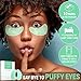 SAFISA Under Eye Patches | aloe vera gel under eye pads 10 pairs | under eye bags treatment, eye mask for puffy eyes, dark circles under eye treatment | anti-aging collagen eye mask | for women & men…