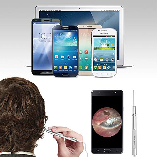 4 Otoscope+Scopearound+Diameter+Ultra+Slim+Adjustable