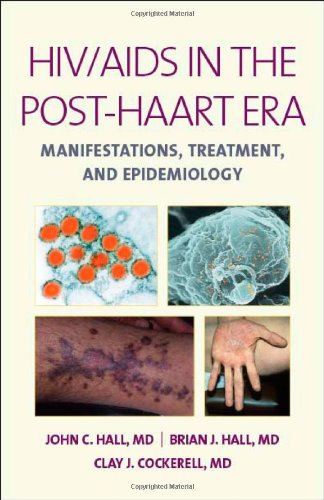 HIV/AIDS IN THE POST-HAART ERA: MANIFESTATIONS, TREATMENT, EPIDEMIOLOGY