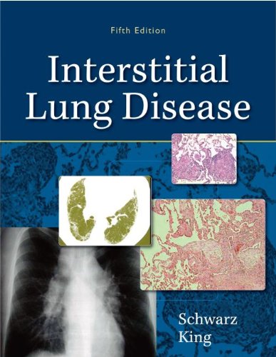 INTERSTITIAL LUNG DISEASE