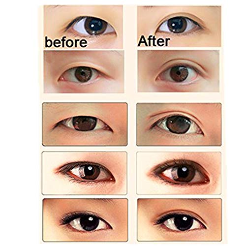Eye Tape Double Eyelid Tape Invisible Eye Stickers Natural Waterproof Eye Tape Adhesive Magic Charm Big Eye Fiber with Y shaped Fork (Silm 300 Pairs)