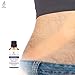 Stretch Mark Remover Synergy - 100% Natural Therapeutic Remedy - Anti Scar and Stretch Marks Removal for Maternity and Weight Loss - 1.7 fl oz / 50ml