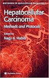 Hepatocellular Carcinoma : Methods and Protocols, , 0896037851