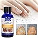Nail Repair, Nail Solution, Natural Nail Treatment, Effective Against Nail Infection Restores Discolored & Damaged Nails