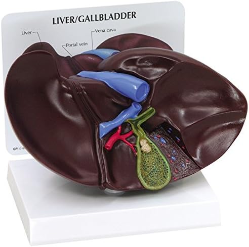 GPI Anatomicals 3300 GPI Anatomicals 3300 Liver - Gallbladder With Gallstones