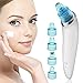 Blackhead Remover, Pore Cleaner, Vacuum Suction Facial Pore Cleaner, Electric Acne Comedone Extractor Kit with 4 Microcrystalline Head for Women and Men Black Heads Extraction