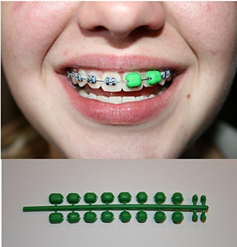 Cheeksaver Protection for Braces Orthodontic Mouth Guard Dental Teeth (Green)
