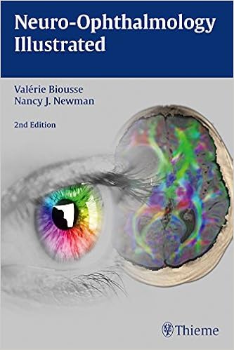 Neuro Ophthalmology Illustrated Kindle Edition By Valerie - 
