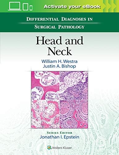 Carpentier's Reconstructive Valve Surgery: 9780721691688: Medicine