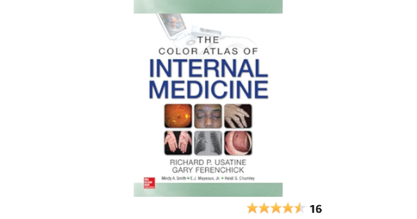 Color Atlas Of Internal Medicine Kindle Edition By Usatine Richard P Ferenchick Gary Smith Mindy Ann Mayeux E J Chumley Heidi Professional Technical Kindle Ebooks Amazon Com