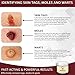 Homeopathic Mole and Skin Tag Remover - Neck Tag Mole Removal Cream (1 oz.) All Natural Herbal Ingredients with Bloodroot, Galangal Root & Graviola for Optimal Effect
