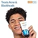 AcneFree Blackhead Removing Exfoliating Face Scrub with 2% Salicylic Acid and Charcoal Jojoba, 5 Ounce - Pack of 2