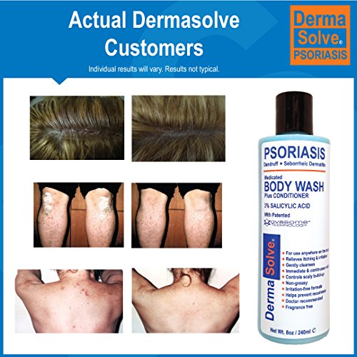 Psoriasis Body Wash by DermaSolve (2Pack) Psoriasis, Eczema
