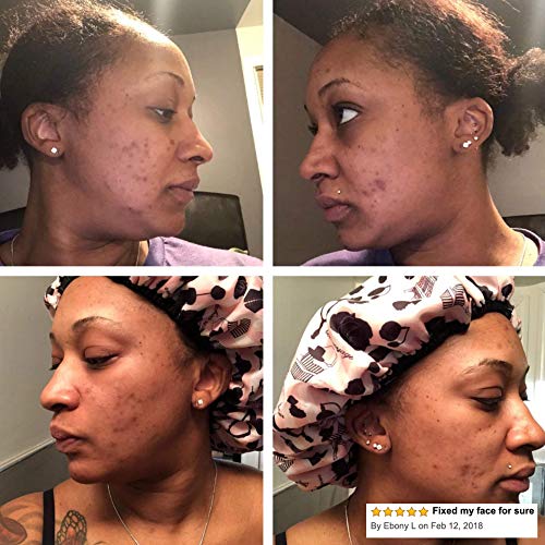 divine derriere skin lightening 2 hydroquinone