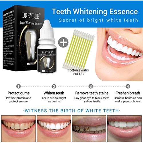 Oguine Teeth Whitening Essence Teeth Cleaning Tool Mint Teeth Whitening Teeth Whitening