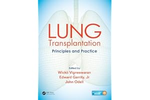 Lung Transplantation: Principles and Practice