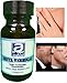 quita verruga Skin Tag Away Wart Remover Sani Skin Skimaway Skim Away Dermanacstrenght Adios a Las Verrugas Sani Tag Skin Skim Away Skim Away Dermanac
