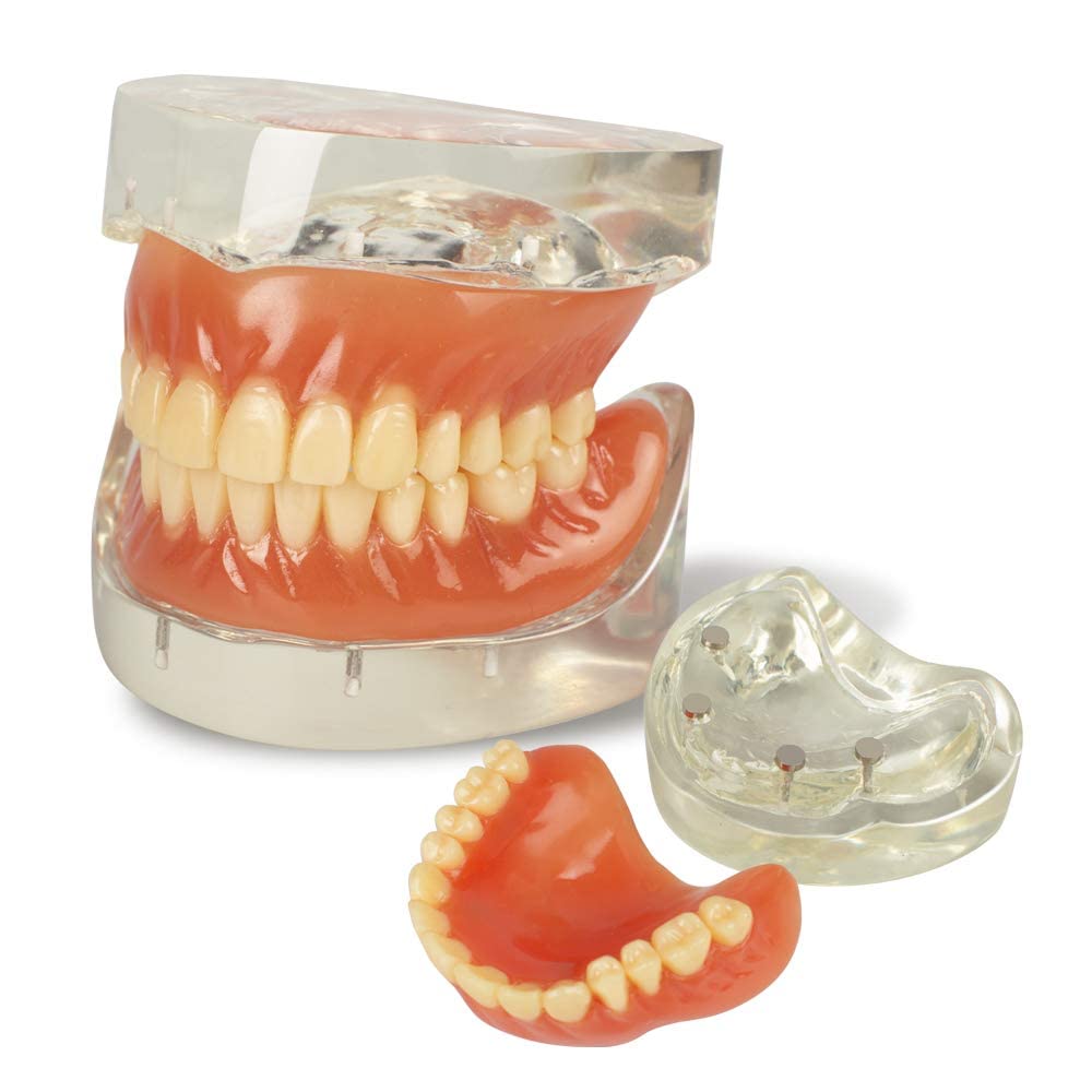 Photo 1 of Teeth Demonstration Model Adult Standard with Removable Teeth for Teaching,Clean Display,Education,Standard Teeth Model