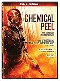 CHEMICAL PEEL                                      image