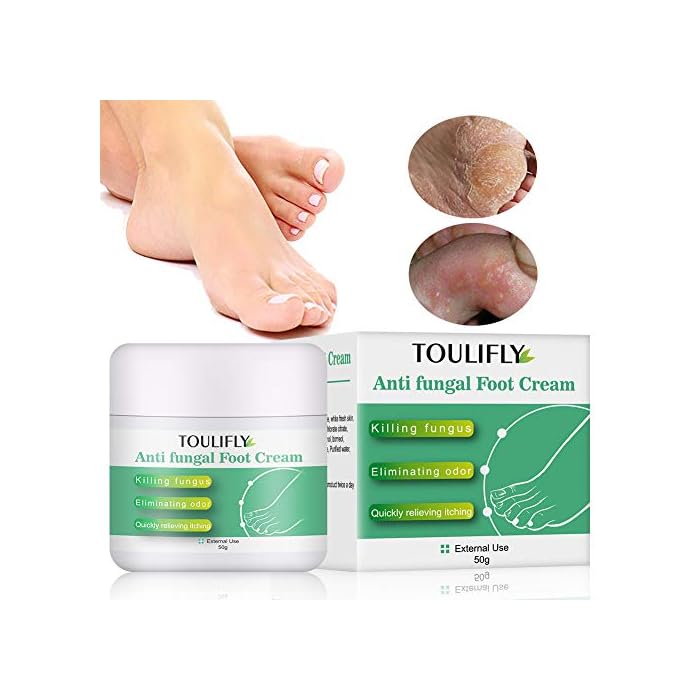Foot Cream,Athletes Foot Cream,Foot Repair Cream,Anti Itch Foot Cream for Athletes Foot Ringworm Moisturizes Cracked…