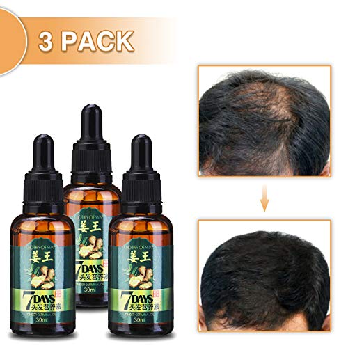 LIUMY Ginger Germinal Oil, Hair Growth Serum-Ginger Essential Oil, Hair Loss Treatment for Women and Men Dense Thicken Hair (30ml)