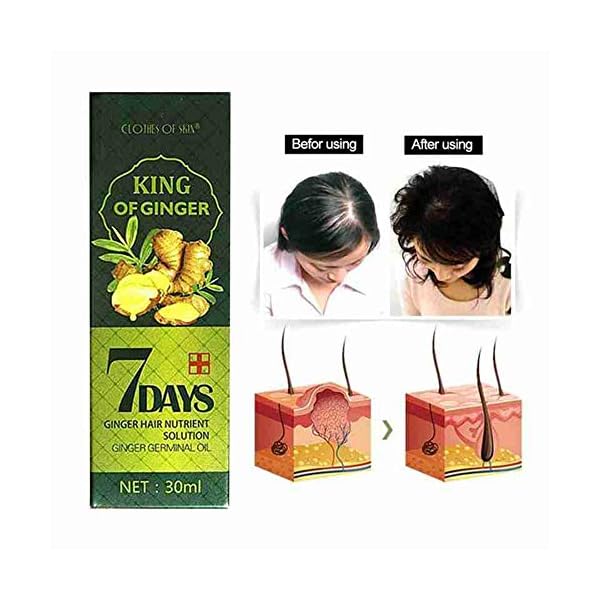 Hair Growth Serum, Hair Care Product, Hair Serum, Fast Hair Growth, Hair Growth & Hair Thickening,Stop Hair Loss, Grow…