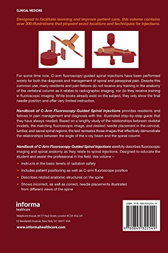 The Handbook of C-Arm Fluoroscopy-Guided Spinal Injections - medicalbooks.filipinodoctors.org