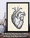 Anatomical Heart - 11x14 Unframed Anatomy Wall Art Print - Vintage Anatomy Poster For Doctors, Nurses, Medical Students and Healthcare Professionals - Great Heart Poster