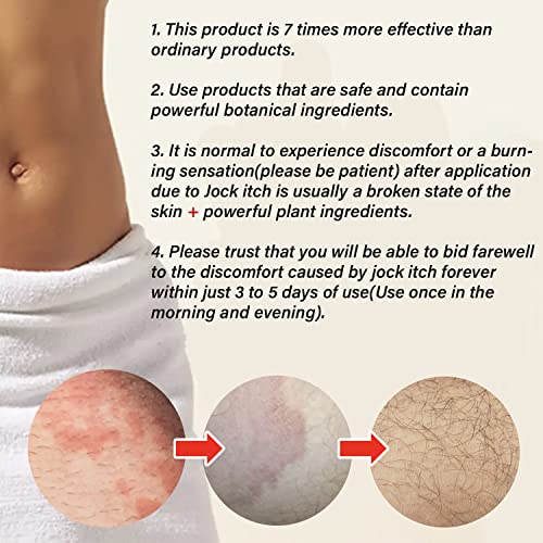 TAGRID Jock Itch Cream, Jock Itch, Tinea Cruris, Jock Itch Cream Extra