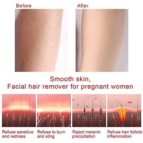 Facial Hair Removal For Women, Painless Professional Facial Hair Remover Electric Shaver For Face Lips Chin Cheeks Arm, Waterproof Razors Epilator Hair Removers For Women(Black)