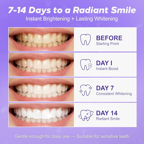 Purple Teeth Whitening Strips 14 Treatments - Enamel-Safe & No-Sensitivity & No-Slip Whitening Strips - Fast Teeth Whitening Result in 7 Days - Whitening Kit for Coffee, Wine Stains Removal