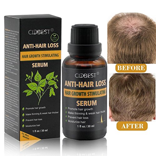 Anti Hair Loss Serum,Anti-Hair Loss Treatment,Natural Herbal Anti Hair Loss Hair Growth Serum-For Thinning Hair, Thickening & Regrowth Product, Fast Hair Growth Serum Support For Men & Women (30ML)