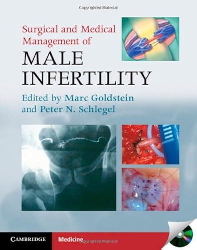 Download Surgical and Medical Management of Male Infertility PDF