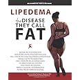 Lipedema - The Disease They Call FAT: An Overview for Clinicians