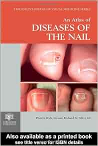 An Atlas Of Diseases Of The Nail Encyclopedia Of Visual