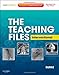 The Teaching Files: Interventional: Expert Consult - Online and Print (Teaching Files in Radiology)