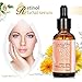 LuckyFine Retinol 2.5 Serum | Retinol Serum with Hyaluronic Acid + Vitamin C,Best Treatment for Acne and Acne Scars, Pigmentation, Fine Lines, Wrinkles and Dark Circles - 30ml (1 fl.oz)