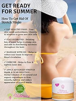 best stretch mark solution