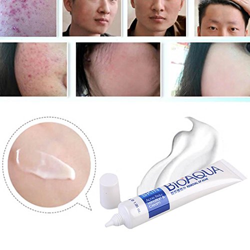 bioaqua removal of acne price