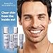 Anti-Acne Serum with Probiotics – Helps Minimize Pores and Get Rid of Blackheads – Natural Acne Treatment for Sensitive Skin - Clear Up Acne and Eliminate Dead Skin Cells (1oz)